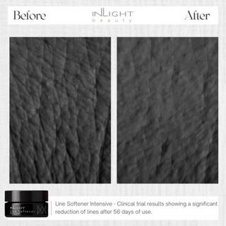 Inlight Beauty Line Softener Intensive