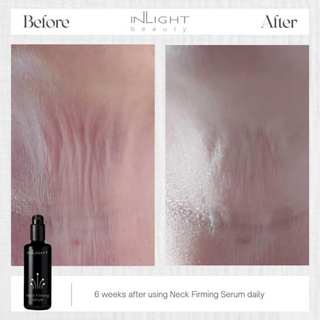 Inlight Beauty Neck Firming Serum